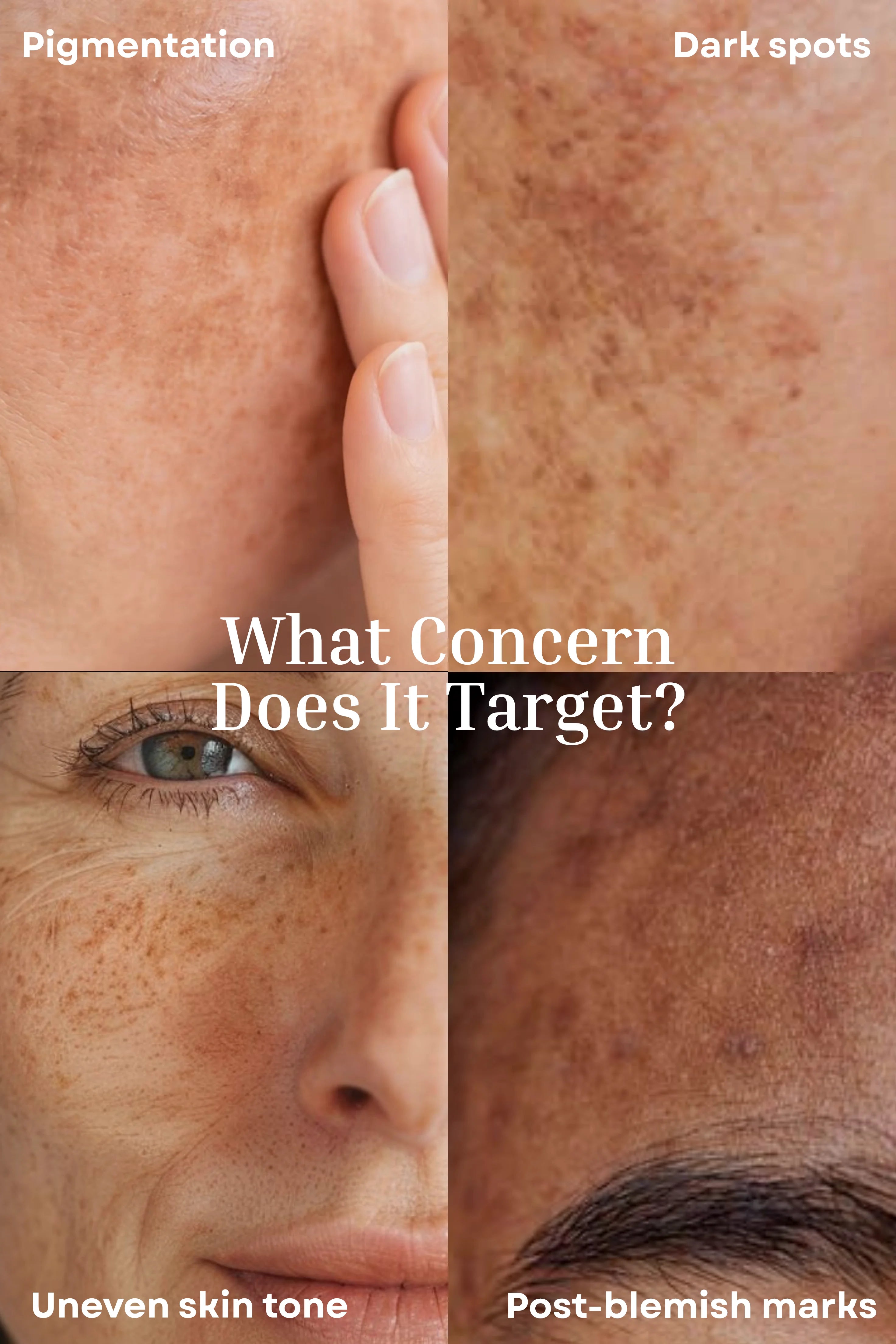 Dark Spot Fade Face Cream <br><br>Tone Perfecting Night Cream | Enhances Skin Clarity | Helps Visibly Fade Dark Spots & Pigmentation - 30g
