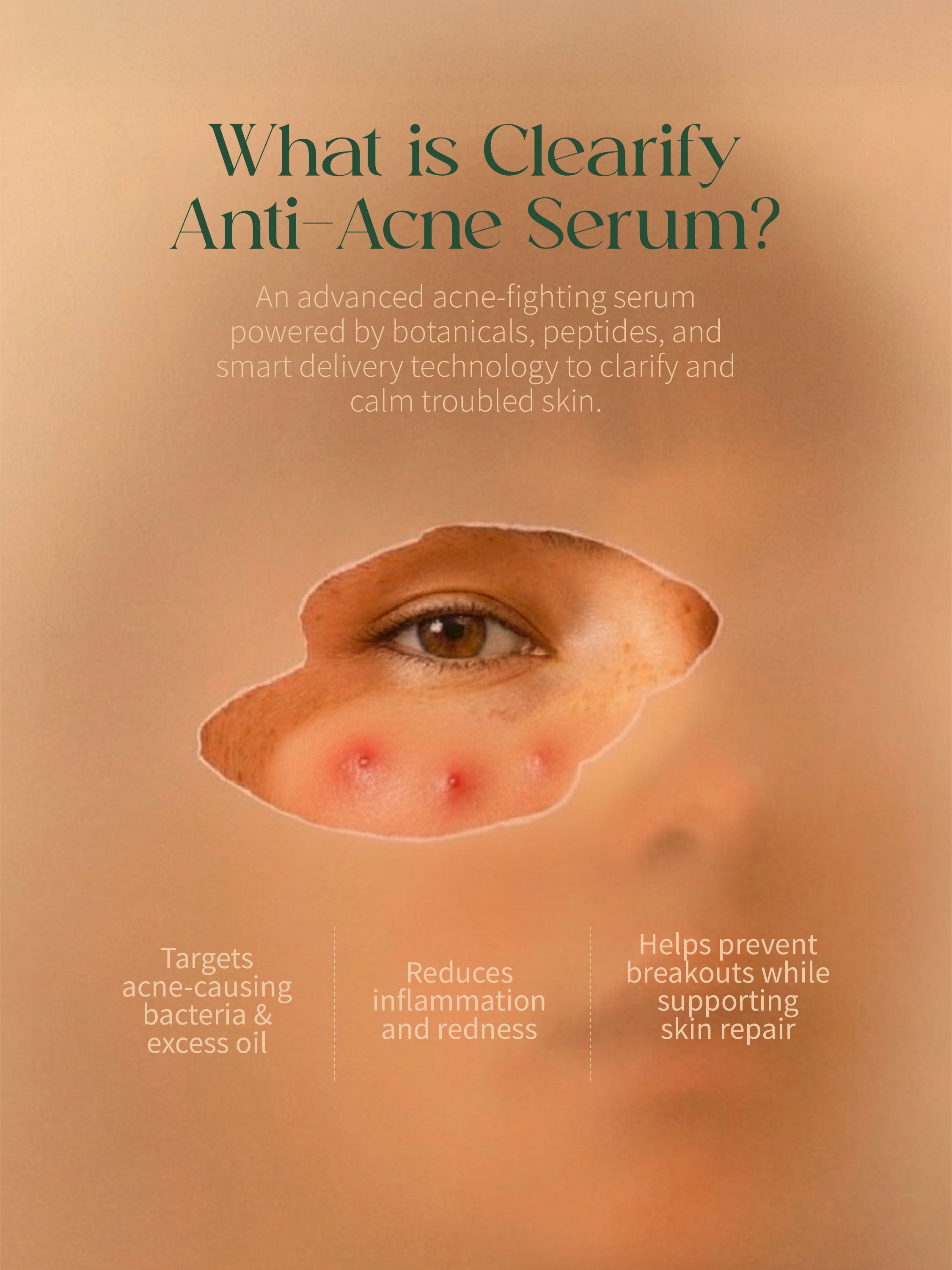 Clearify Anti-Acne Serum