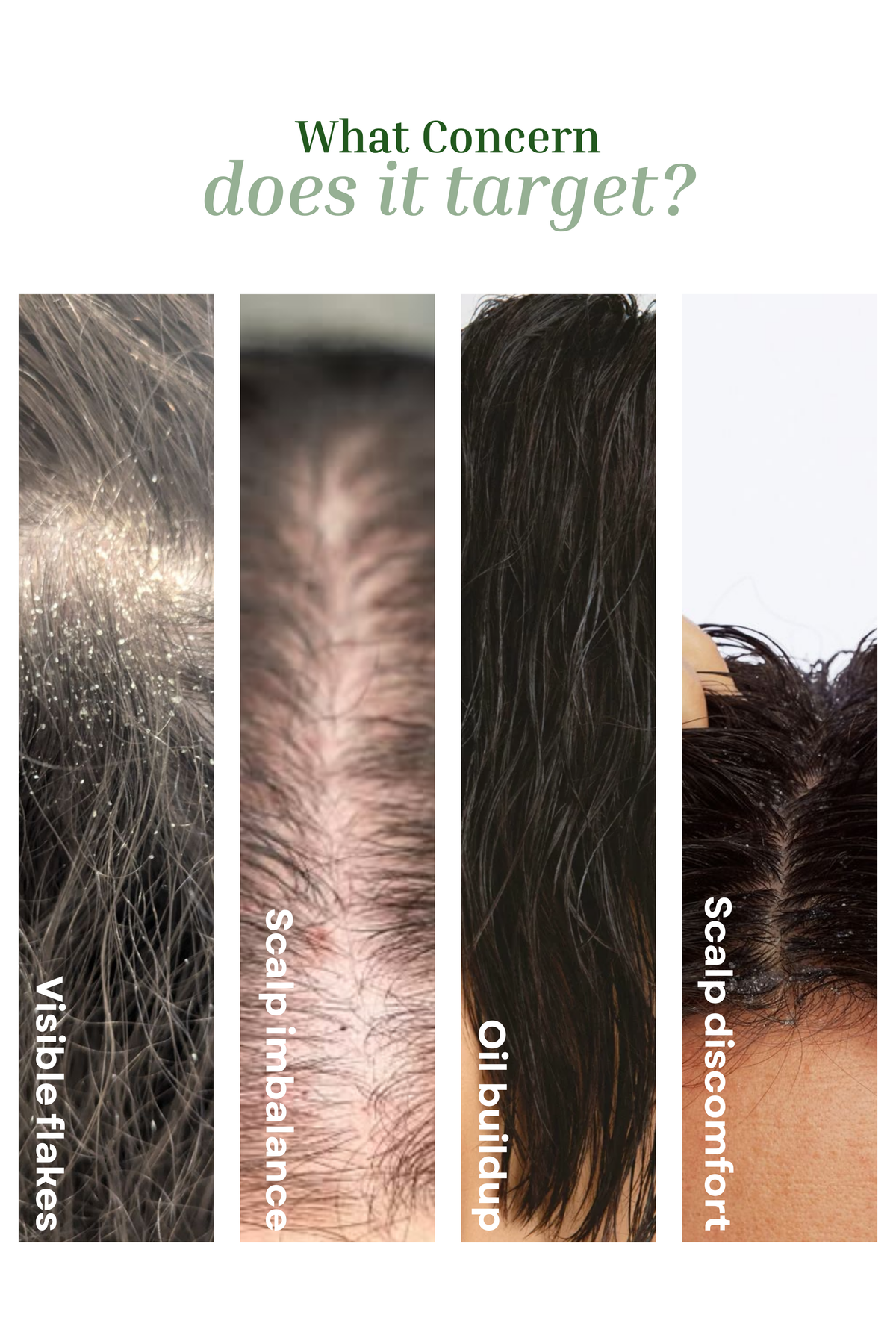 Flake Control Hair Serum